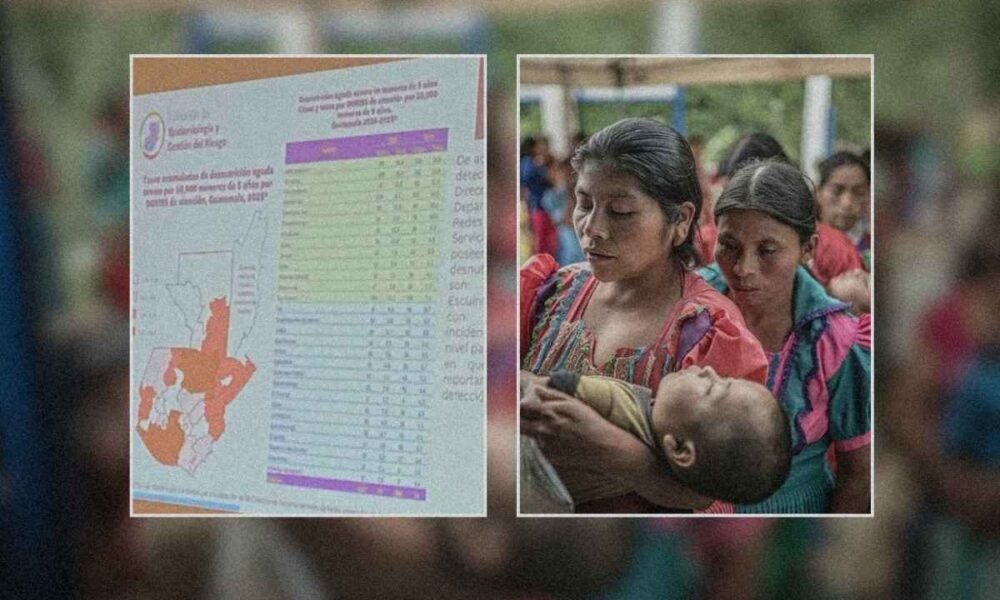 Preocupa alza de desnutrición aguda en menores guatemaltecos en 2025, según datos oficiales