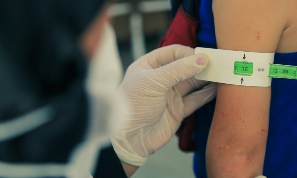 Desnutrición infantil deja 11 muertes y más de 8 mil casos en Guatemala