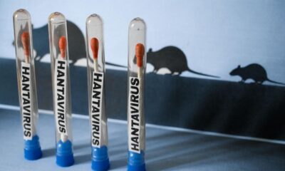 Guatemala sin casos de hantavirus