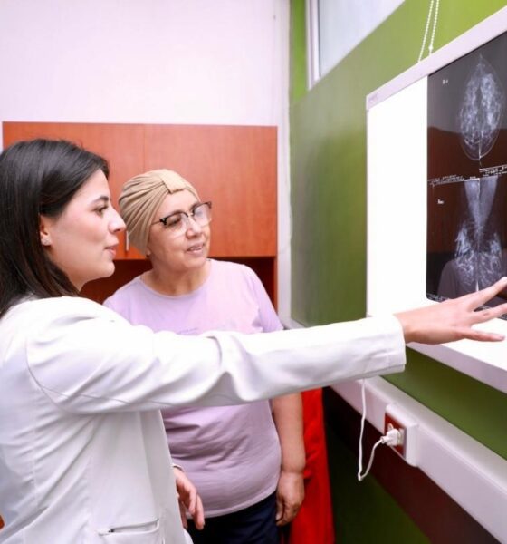 IGSS incorpora prótesis mamarias externas para pacientes con cáncer de mama