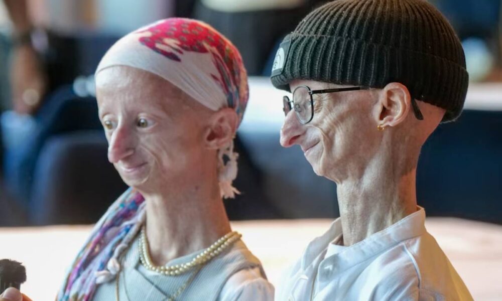Michiel Vandeweert la historia del joven que vivió más allá de los pronósticos de la progeria