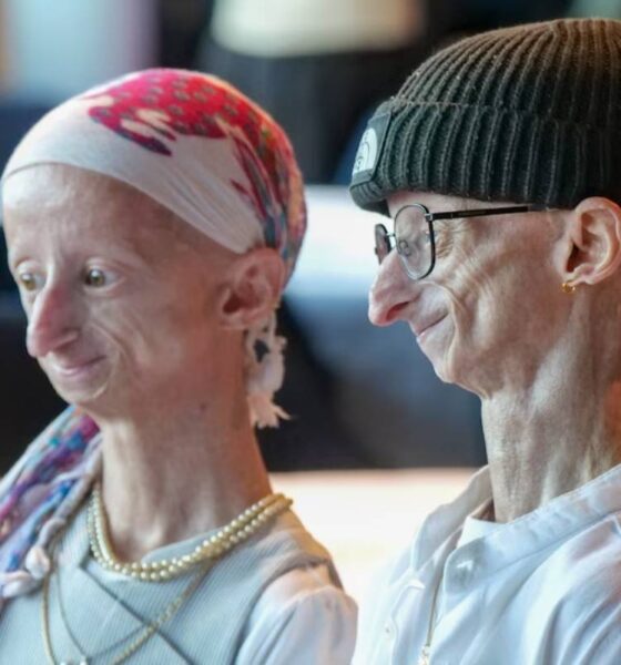 Michiel Vandeweert la historia del joven que vivió más allá de los pronósticos de la progeria
