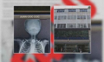 Hospital Roosevelt desmiente colecta falsa por niño que tragó moneda