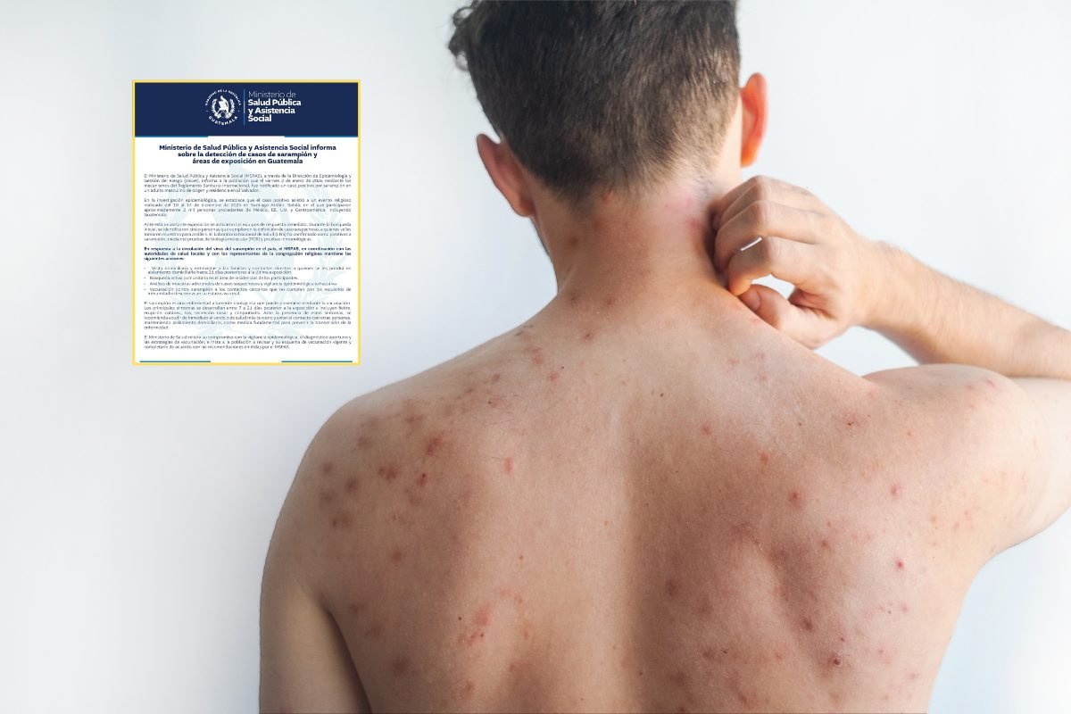 Cinco contagios confirmados tras evento religioso en Sololá